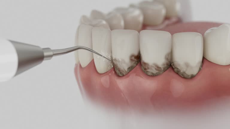 Trusted Tooth Extraction service in Kilmarnock, VA - Dentist Open Now